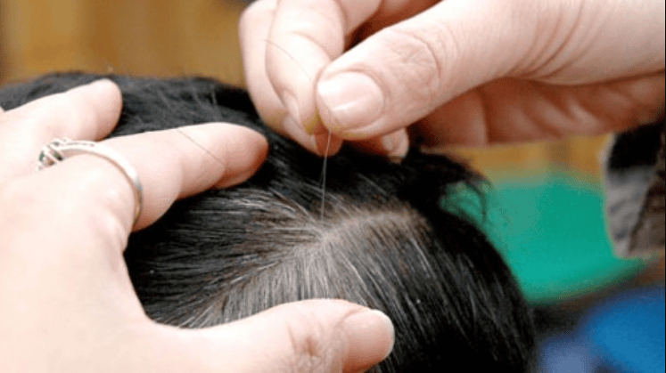 Nằm Mơ Thấy Lửa Cháy Đánh Đề Con Gì? Giải Mã Chi Tiết