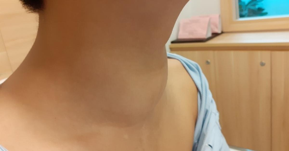 Cá trên cạn khó thở