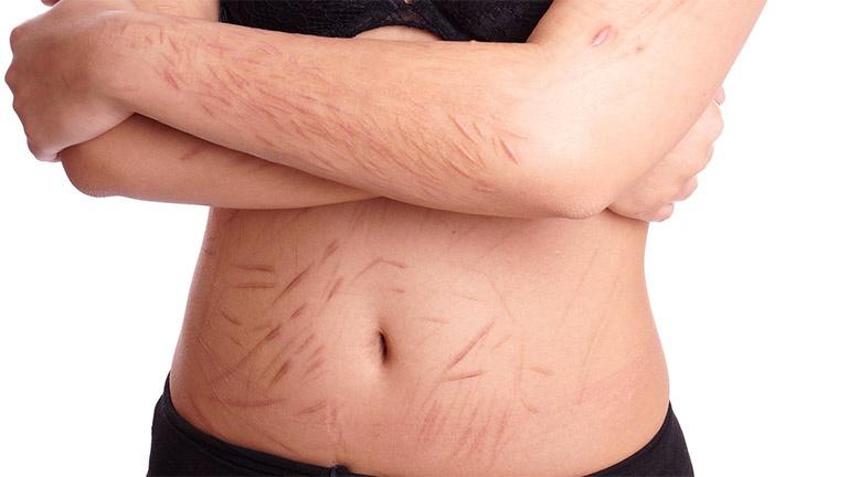 Nằm Mơ Thấy Chồng Ngoại Tình Đánh Con Gì?