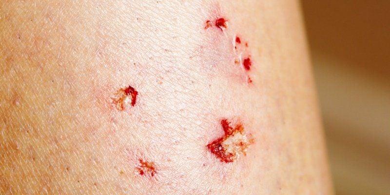 Giải Mã Giấc Mơ Mình: Điềm Báo Và Con Số May Mắn
