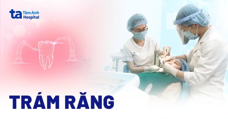 Đi trám răng