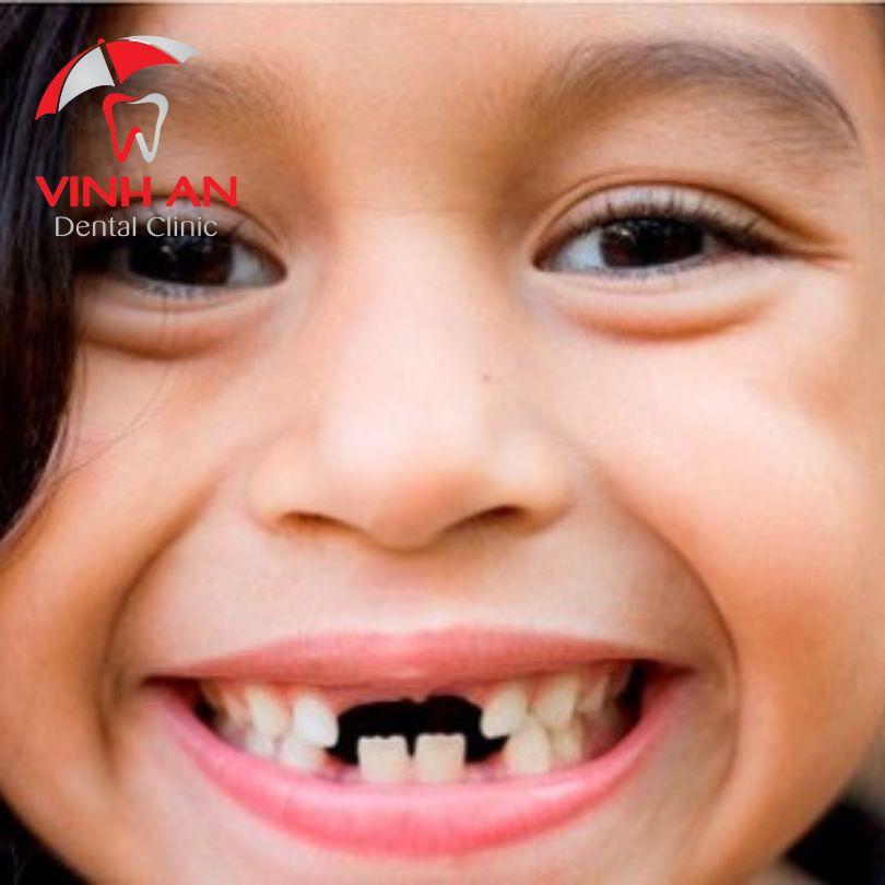 Nằm Mơ Thấy Cháy Ví Tiền: Điềm Báo Gì Về Tài Lộc?
