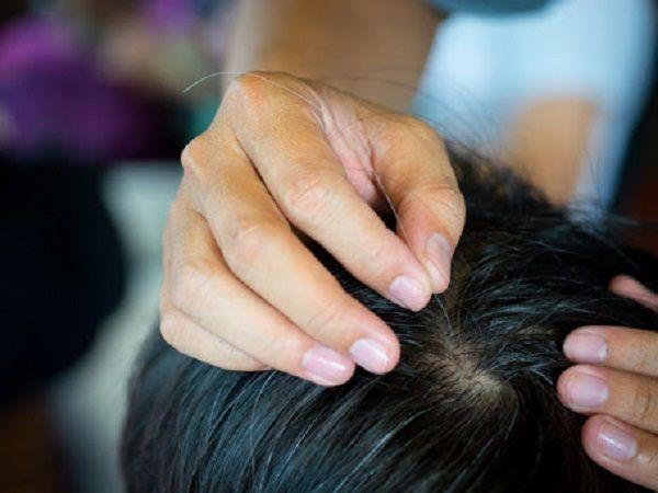 Giải mã giấc mơ nhổ tóc bạc