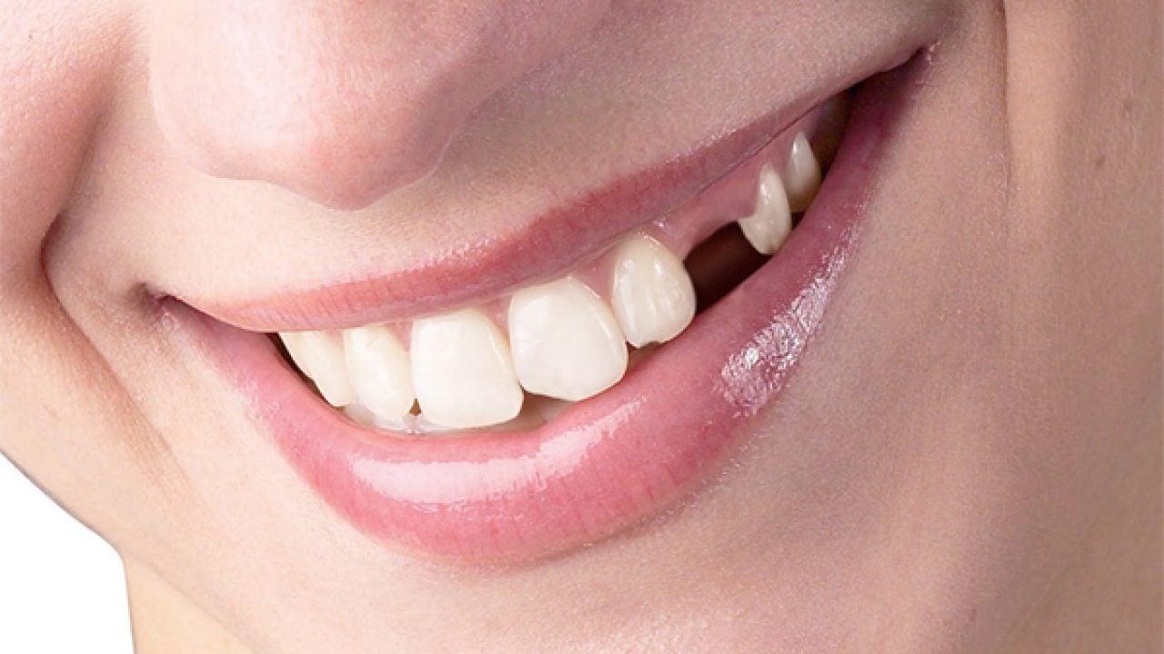 Nằm Mơ Thấy Hôn Thần Tượng: Giải Mã Và Số Đề Liên Quan