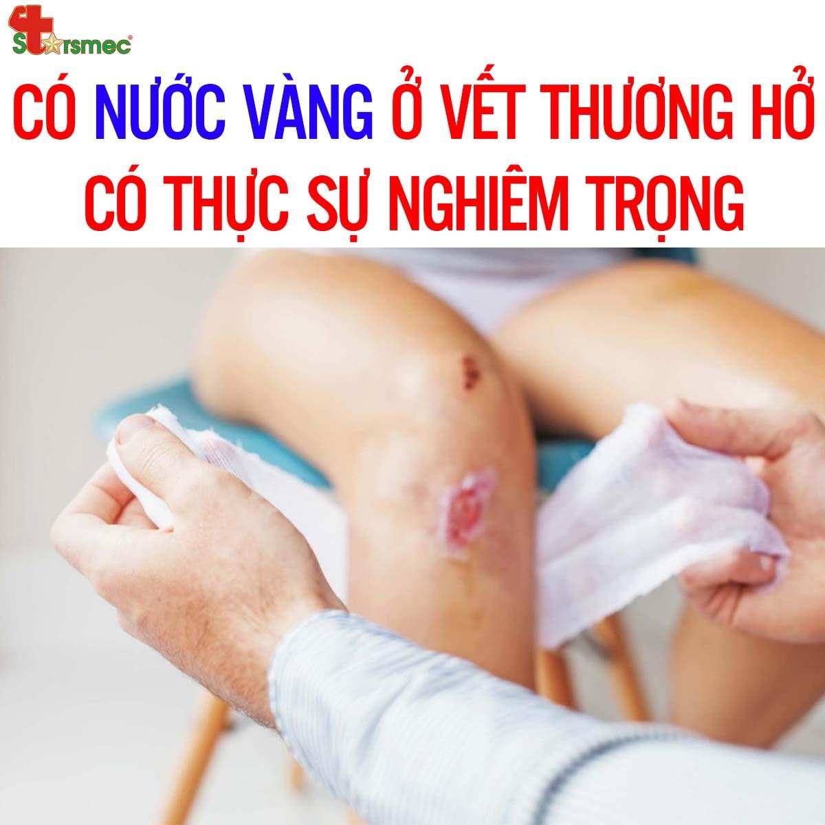 Nằm Mơ Thấy Bị Chửi Đánh Số Mấy?