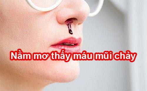 Mơ thấy mình chảy máu mũi đánh con gì?