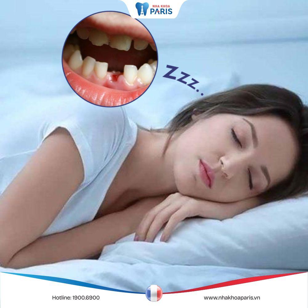 Mơ Thấy Rụng Nhiều Răng