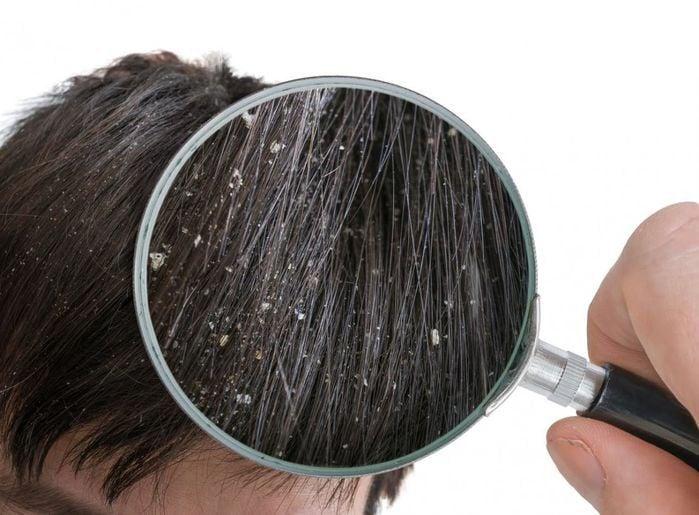 Nằm Mơ Thấy Sinh Con Gái Đánh Số May