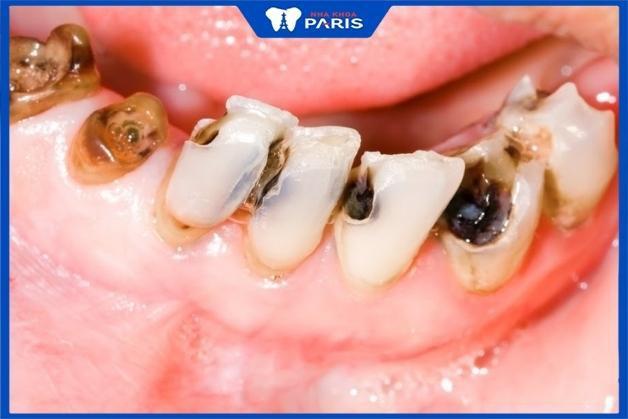 Nằm Mơ Thấy Máy Bay Đánh Đề Con Gì?