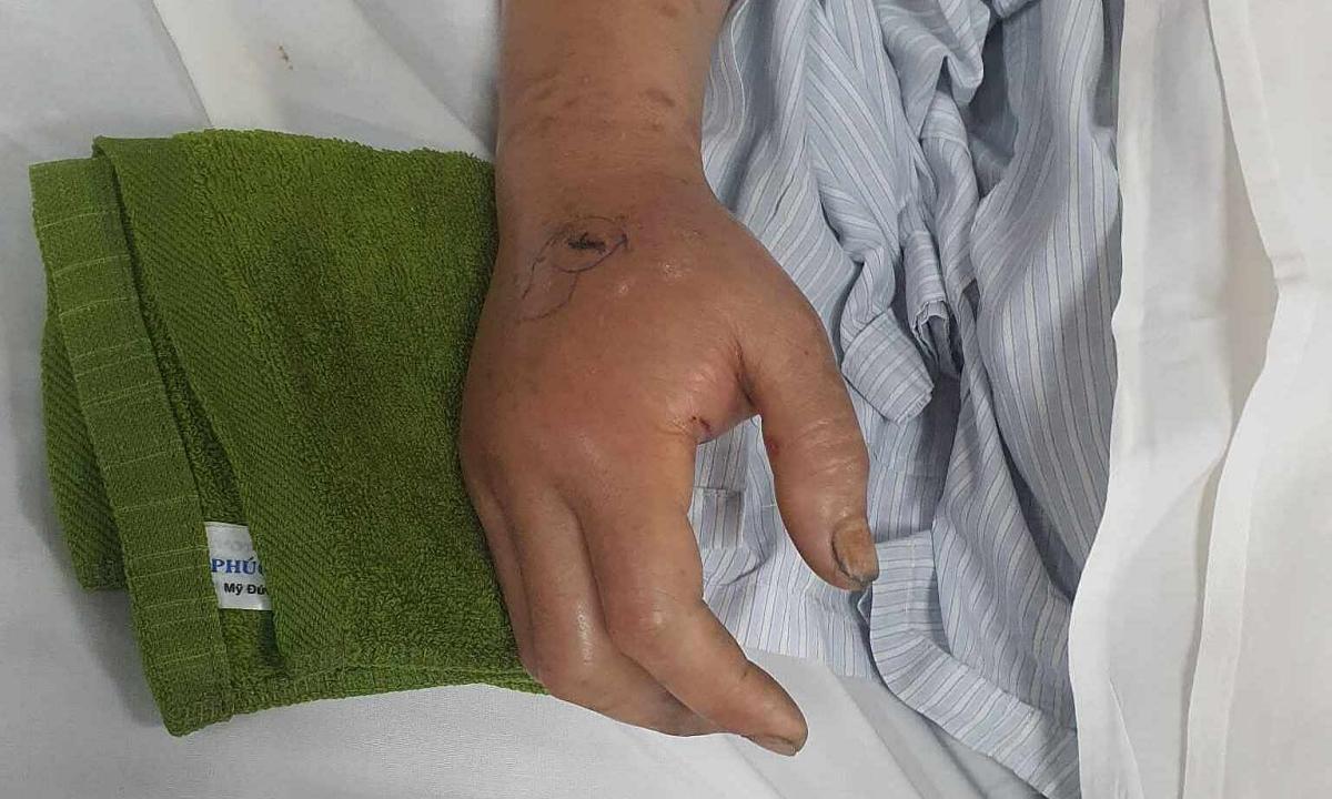 Đêm Qua Anh Nằm Mơ Bỗng Thấy… Giải Mã Giấc Mơ Thành Lộc Số
