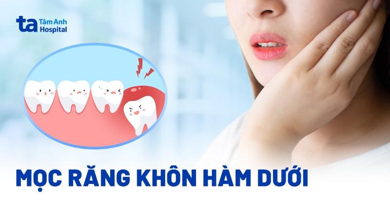 Giải Mã Giấc Mơ Thấy Người Ta Đeo Vàng Và Con Số May Mắn