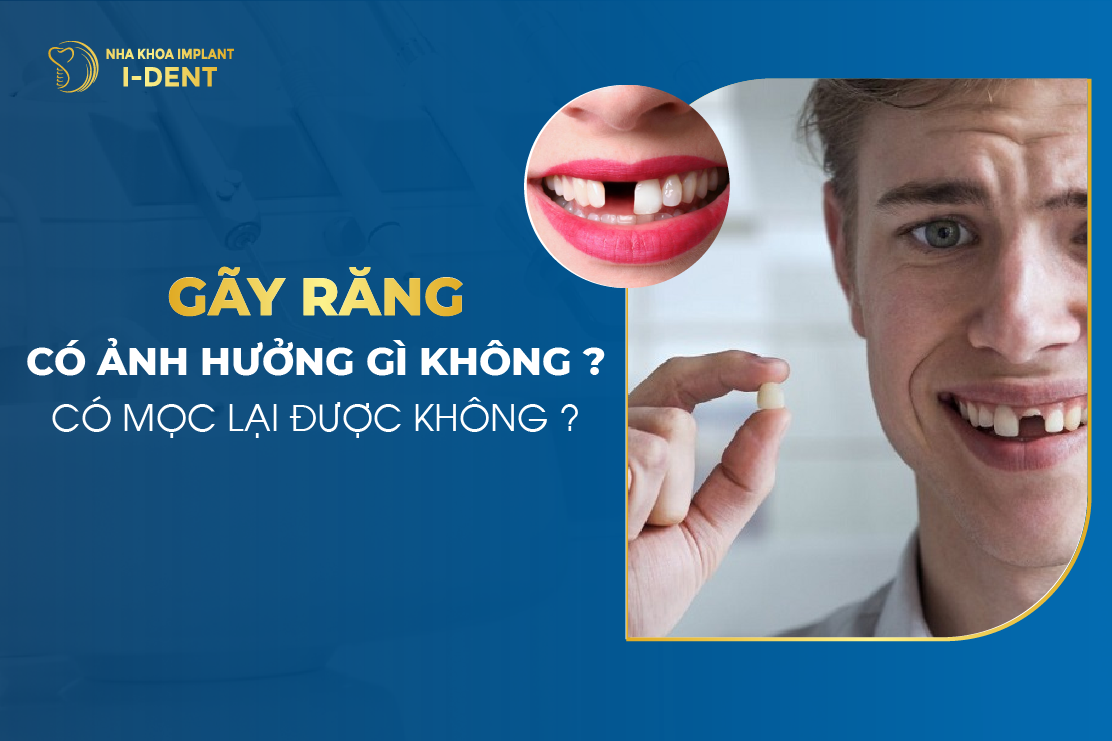 Rụng Răng Hàm Dưới Lo Lắng