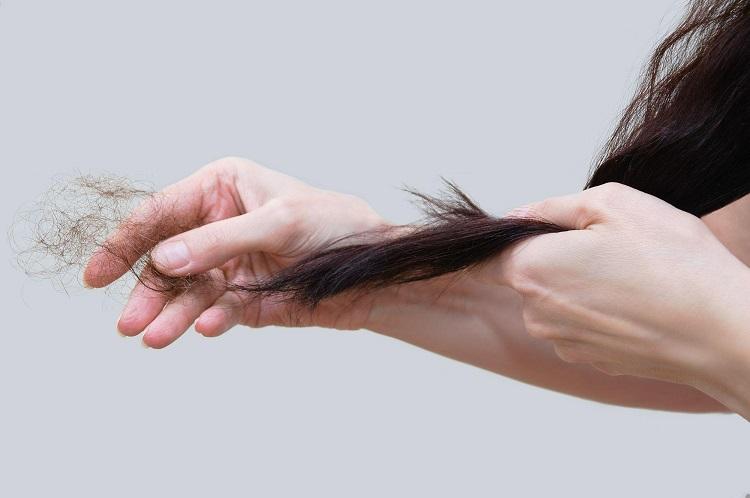 Giải Mã Giấc Mơ Thấy Mình Bị Mất Xe Máy