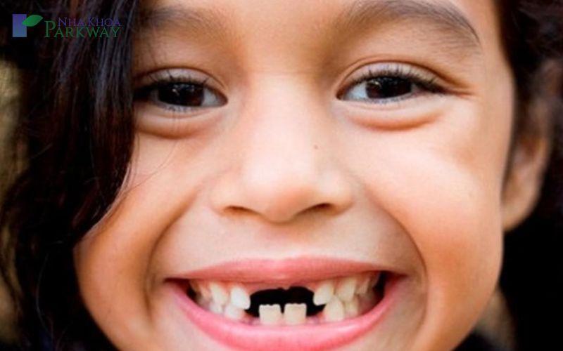 Mơ thấy trám răng bị rụng